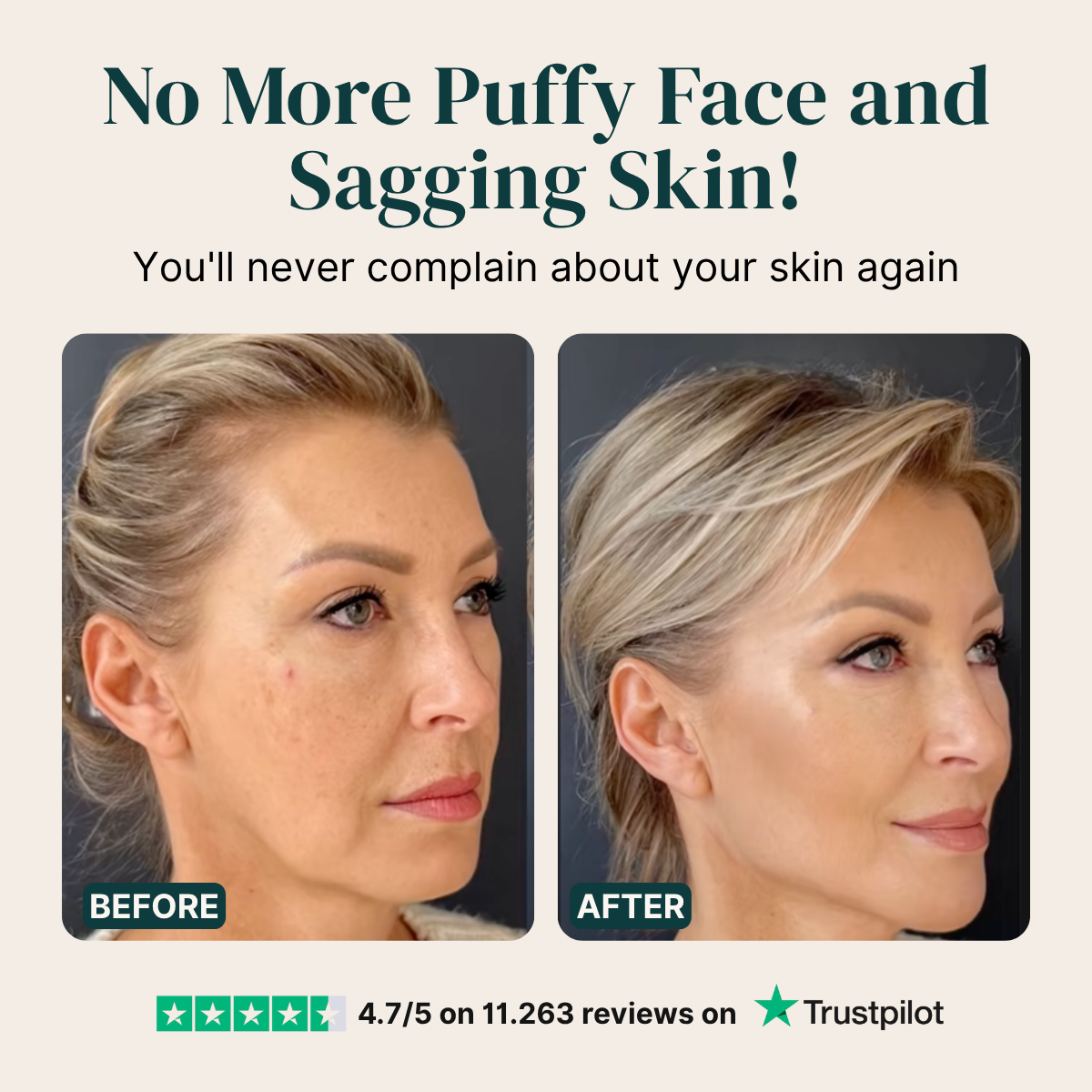 De-Puff and Define in 60 Seconds. Lymph, Not Muscle.